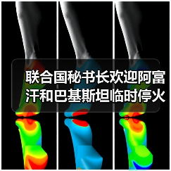 联合国秘书长欢迎阿富汗和巴基斯坦临时停火 联合国秘书长欢迎阿富汗和巴基斯坦临时停火